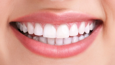 Estetica Dental